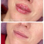 VIBgallery10 VIBgallery10