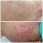 VIBgallery11 VIBgallery11