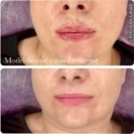 VIBgallery6 VIBgallery6