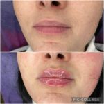 VIBgallery7 VIBgallery7